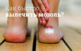 Как избавиться от мозолей на ногах?