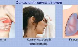 Симпатэктомия от повышенной потливости