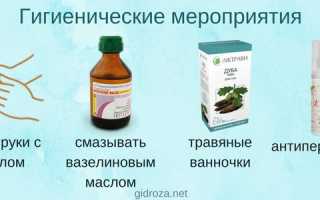 Потливость ладоней