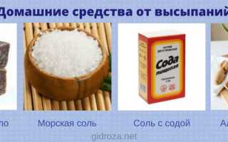 Прыщи от пота на теле