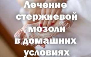 Убираем стержневую мозоль дома
