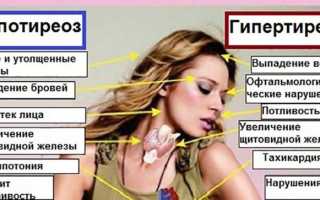 Воспаление щитовидной железы, симптомы у женщин