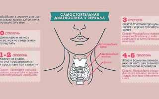 Внешние признаки заболевания щитовидной железы