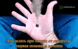 Оказание первой помощи при сигаретном ожоге