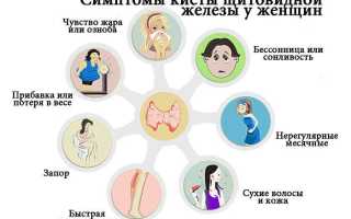 Киста щитовидной железы — причины образования