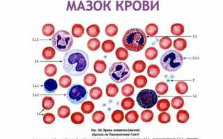 Мазок крови: что это за анализ, и как он расшифровывается