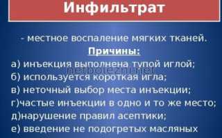 После укола в ягодицу появилось уплотнение