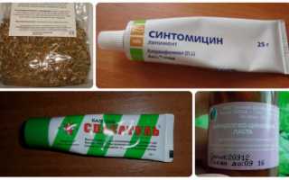 Мази от мозолей — список эффективных препаратов для обработки и заживления мозолей