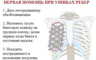 Лечение ушиба ребра в домашних условиях