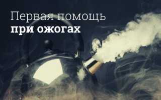 Ожог: чем лечить в домашних условиях?