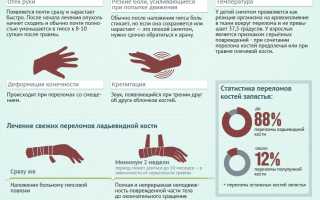 Ушиб руки