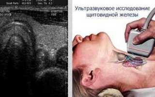 Анализ и диагностика структуры щитовидной железы