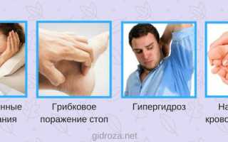 Запах ног у мужчин